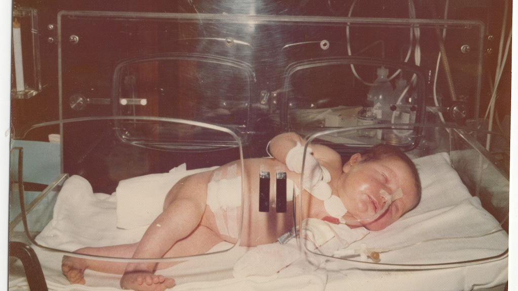 Femke werd een dag na haar geboorte geopereerd aan haar slokdarm. 